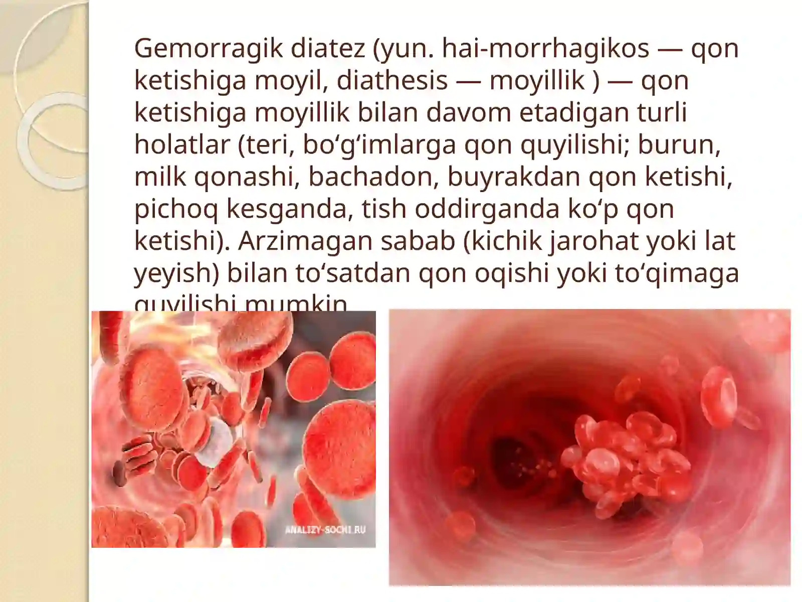 Gemorragik diatezlarning ko’rinishlari 2