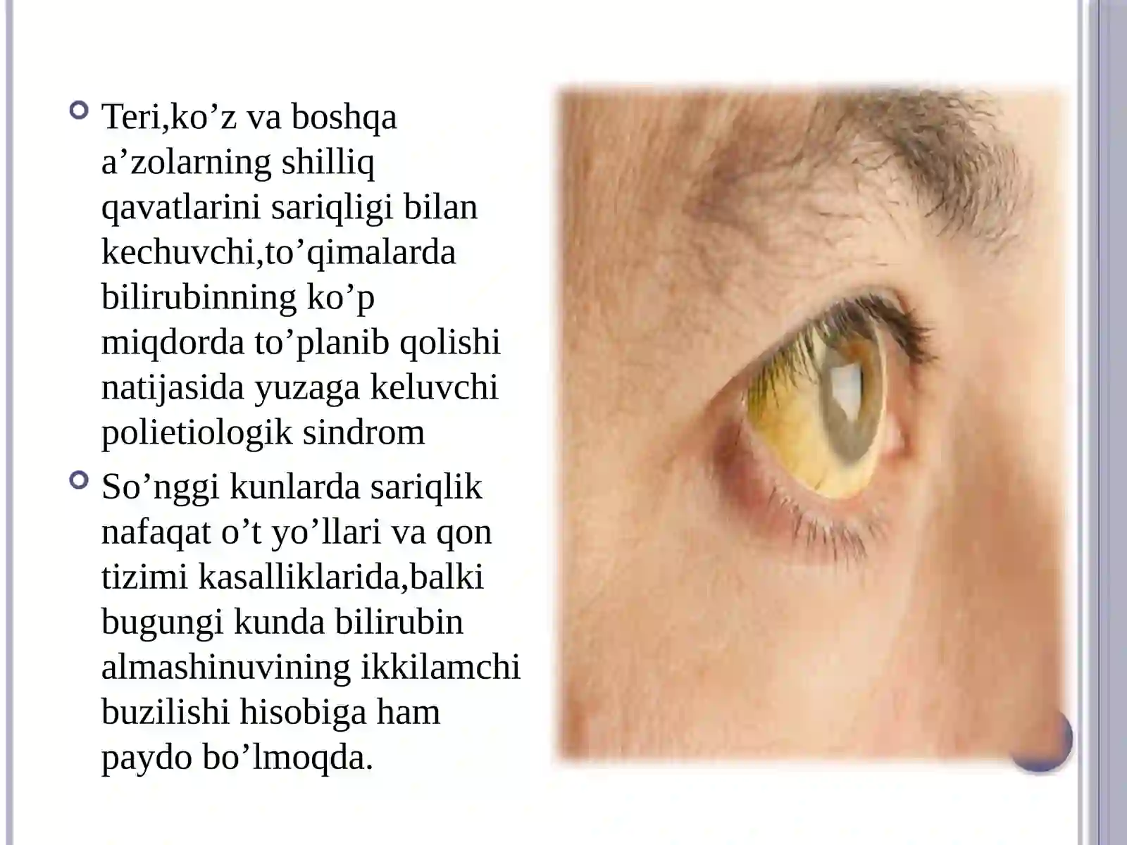 SARIQLIK 2