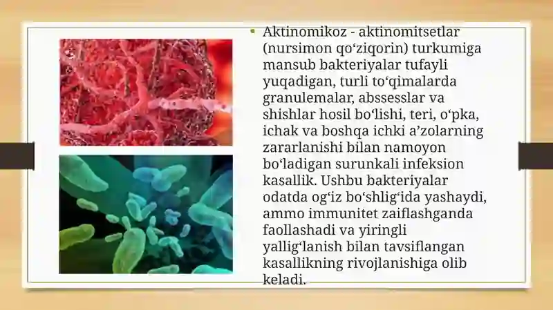 Aktinomikoz 2