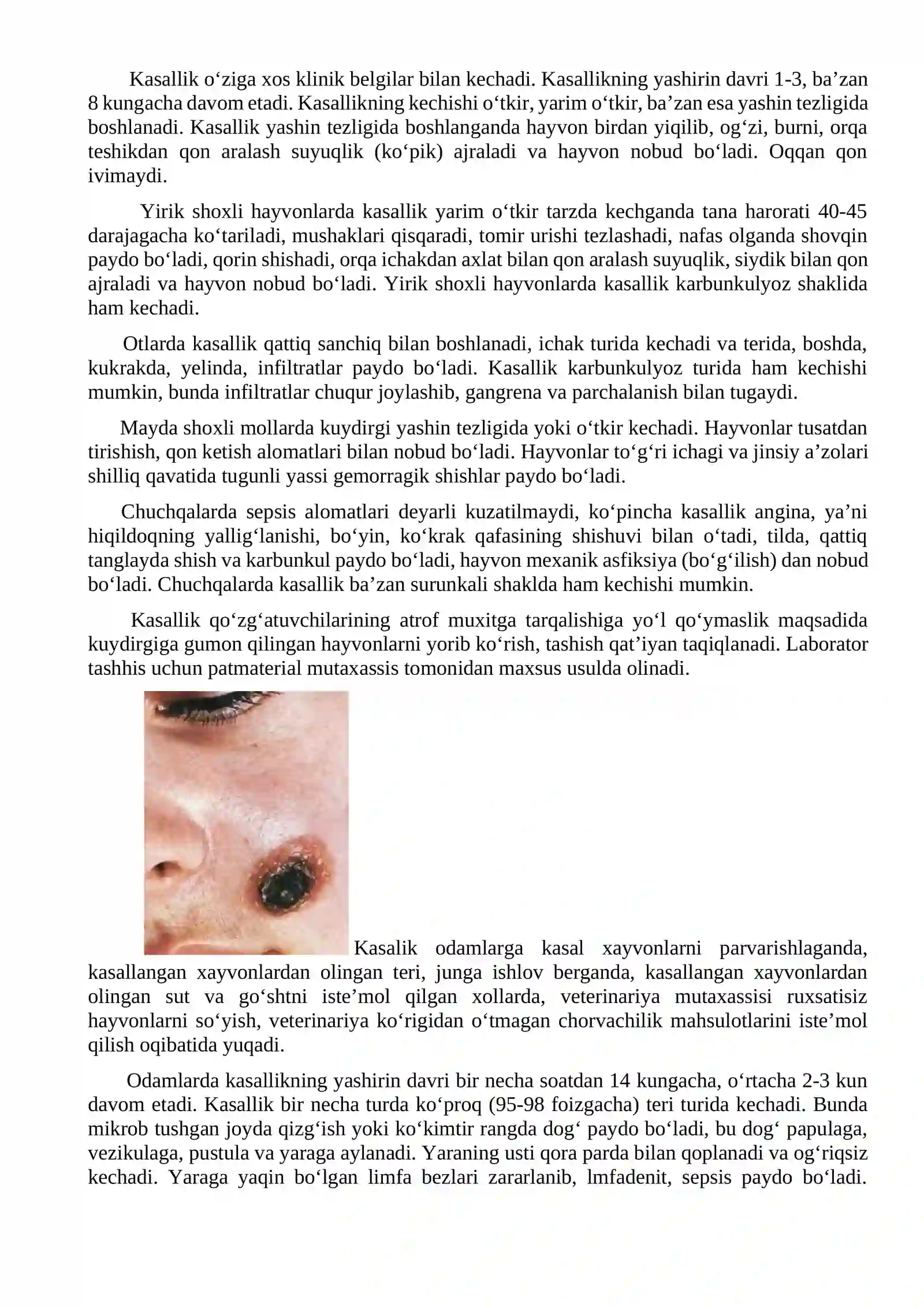 Kuydirgi kasalligi va uning profilaktikasi 2