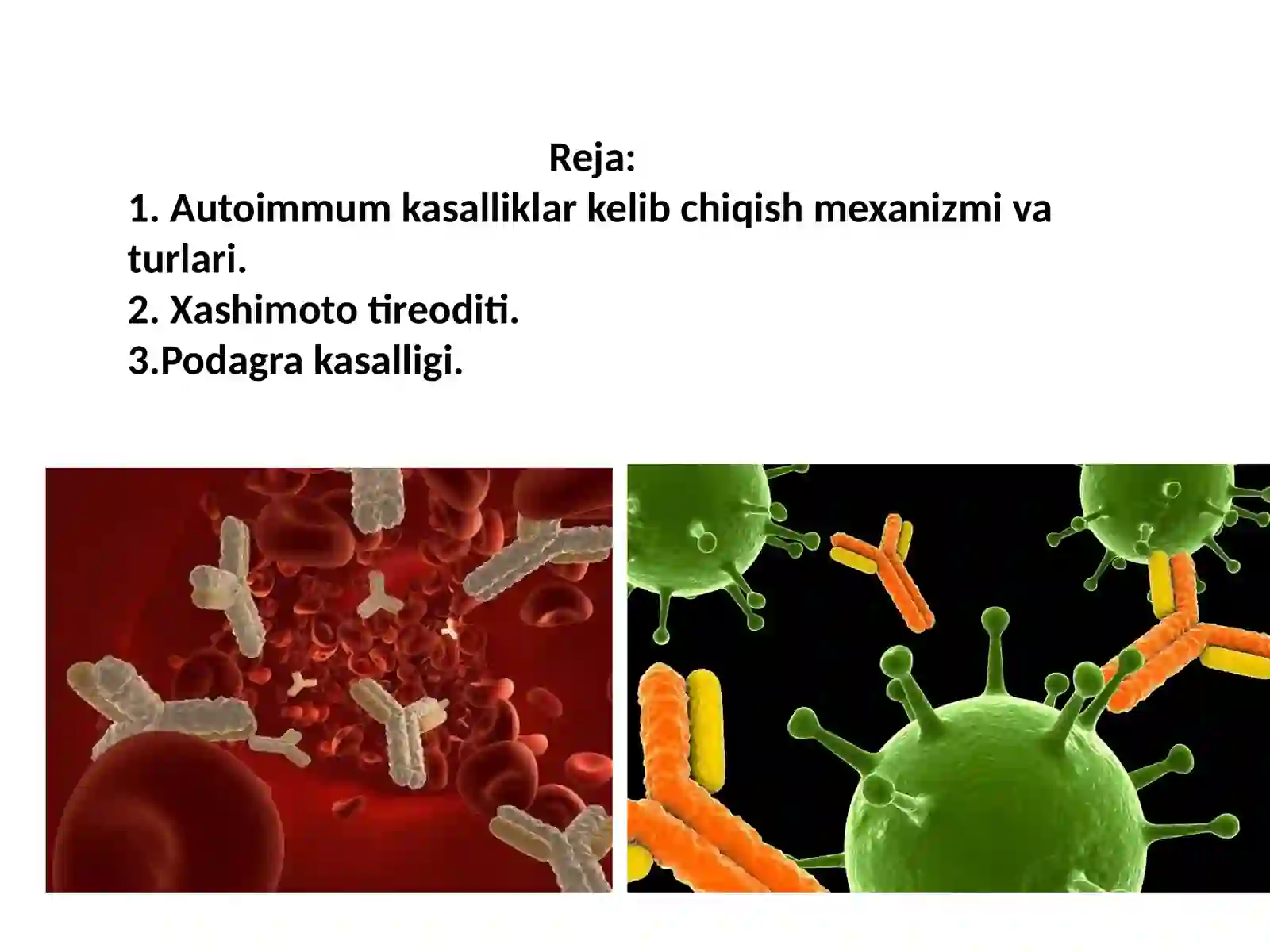 Autoimmun kasalliklar 2