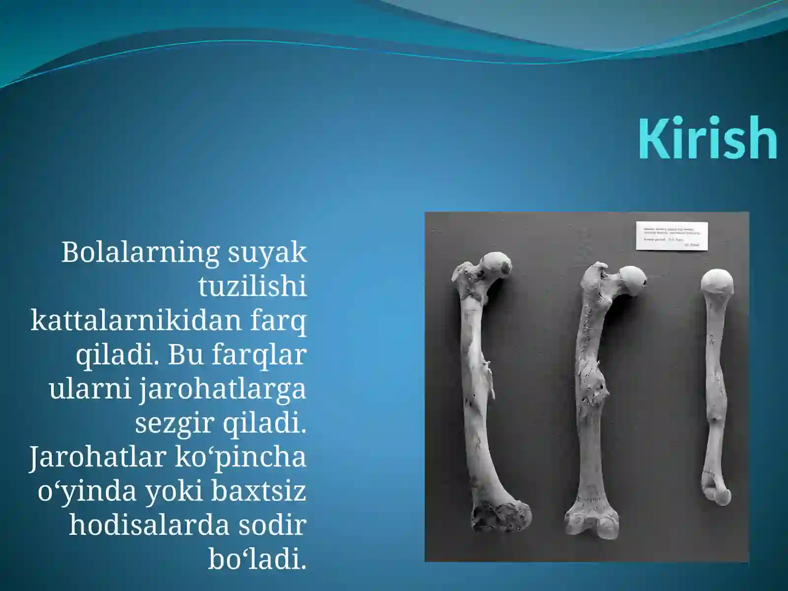 Bolalarda O‘ziga Xos Jarohatlanish 2