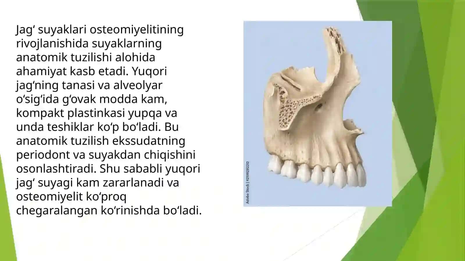 Yuqori va pastki jag'osteomiyeliti 2