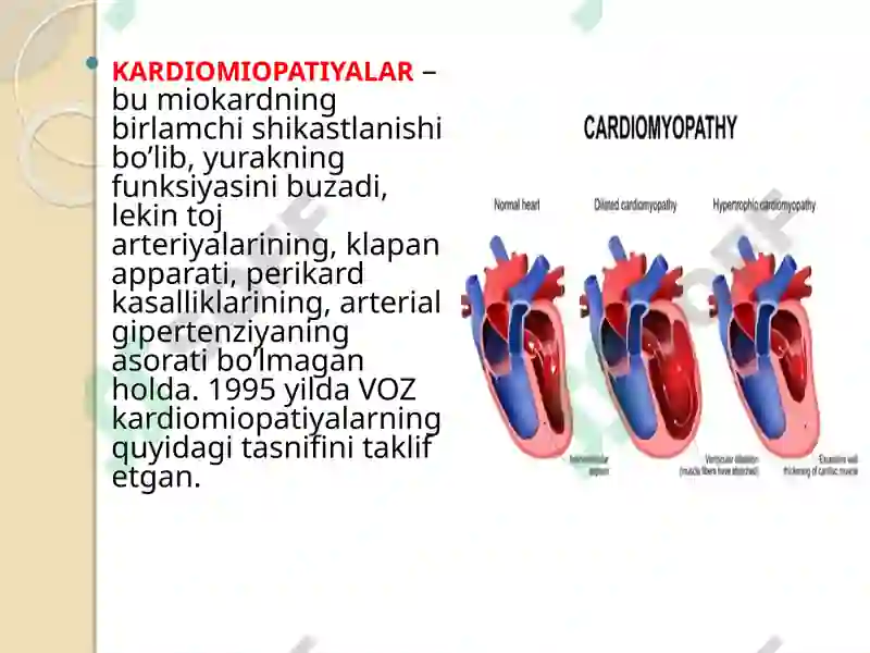 Kardiomiopatiya 2