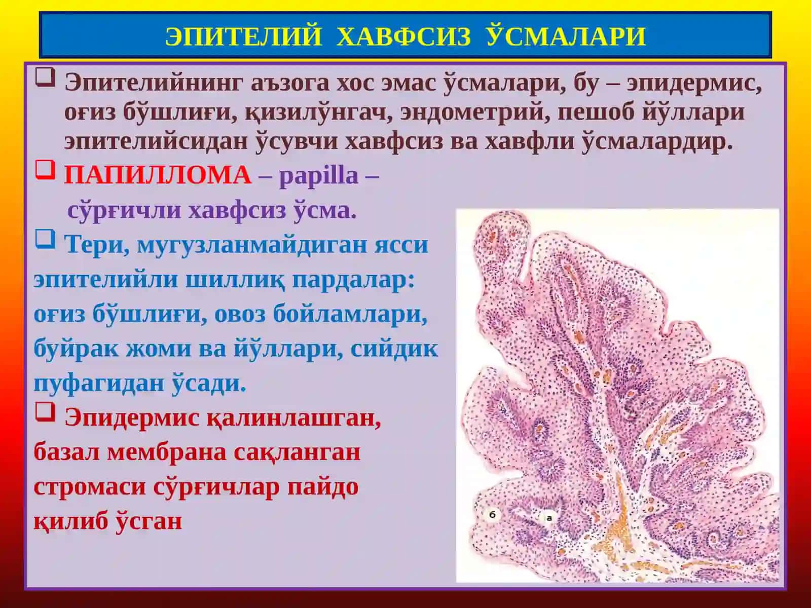 ПАТОЛОГИК АНАТОМИЯ “Ўсмалар. Мезенхимал ўсмалар” 2