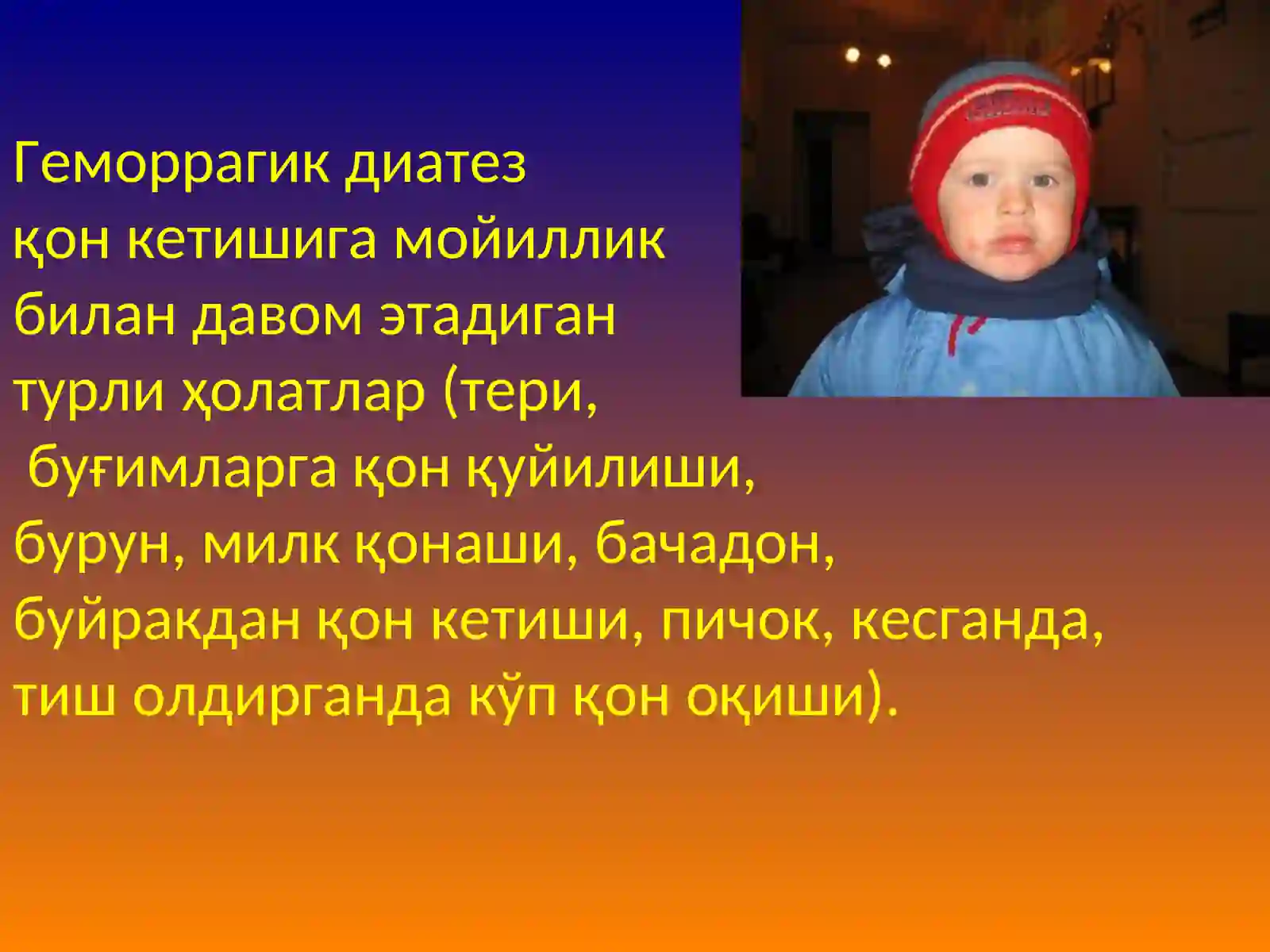 Геморрагик диатезлар 2