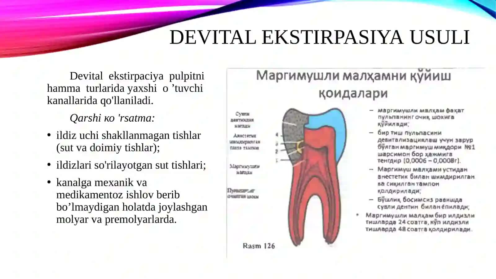 Devitalekstrepatsiya usuli 2