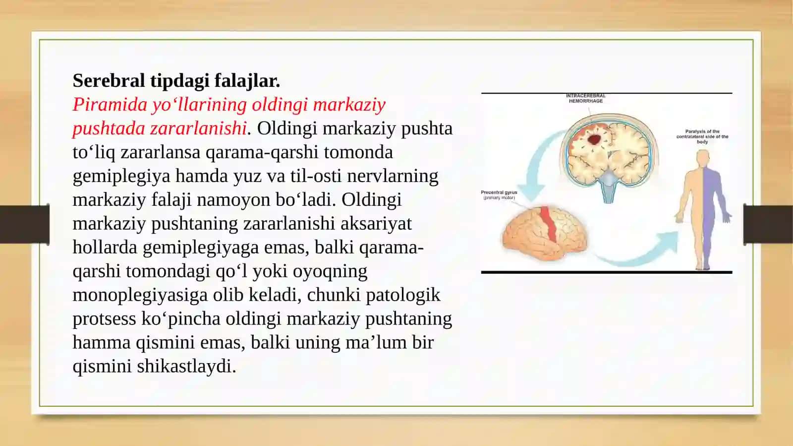 Harakat yo‘lining zararlanishi ni topik diagnostikasi 2