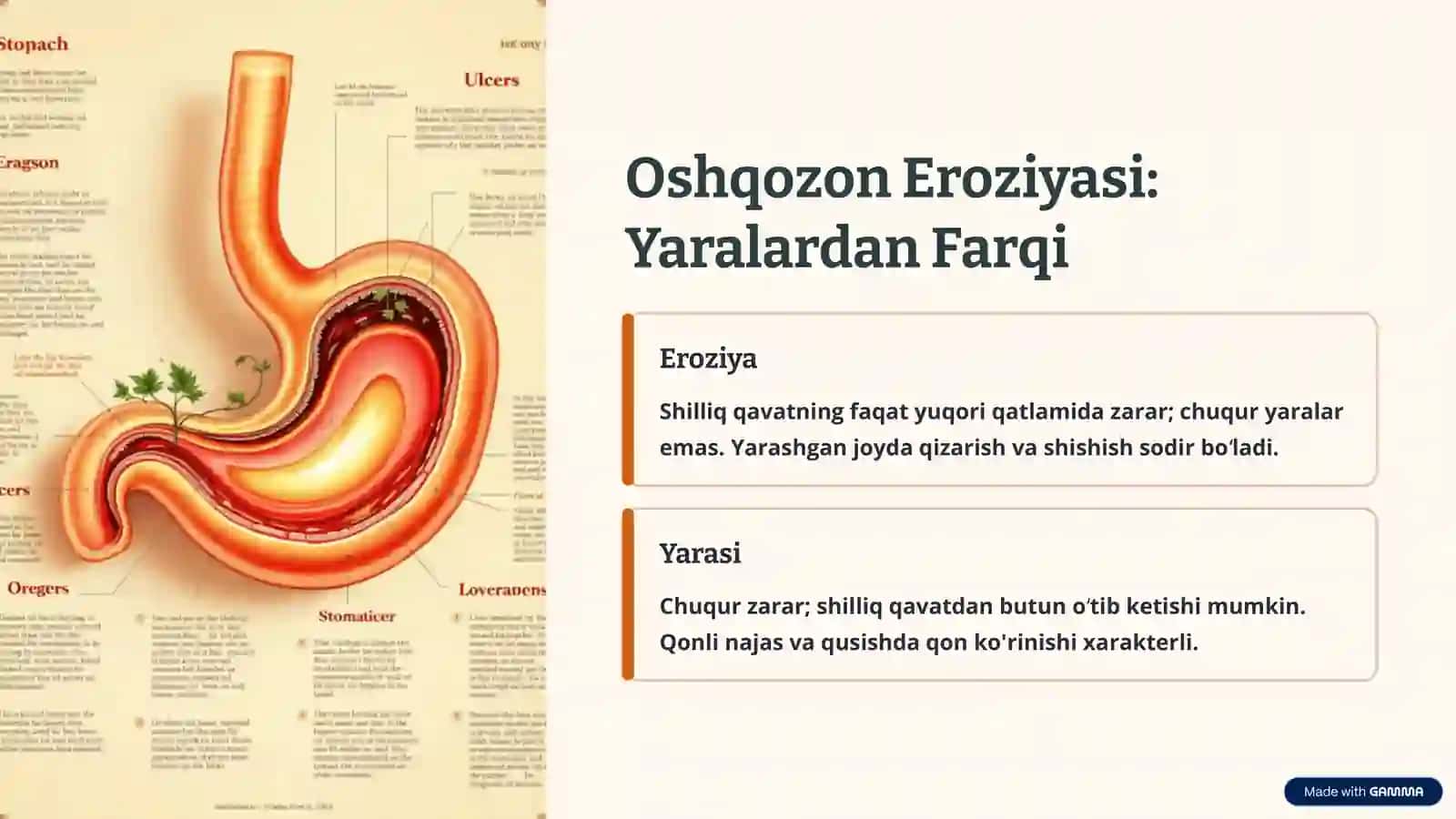 o'tkir oshqozon yaralari 3