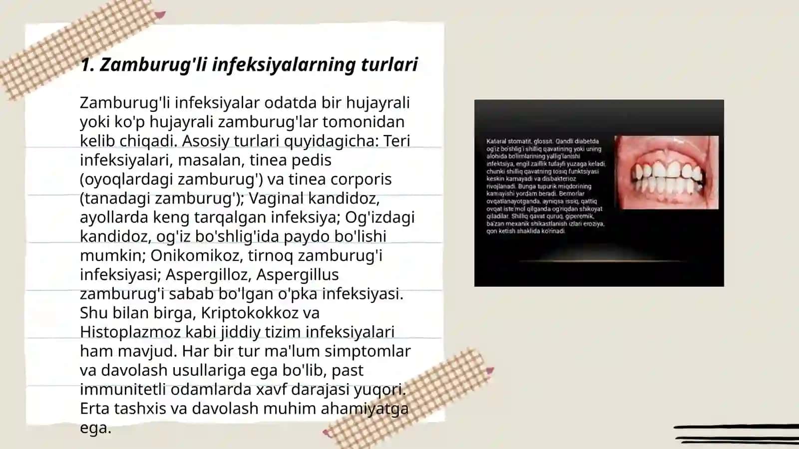 Zamburuqli infeksiyalar va ularning og'iz boshlig'ida namoyon bo'lishi 3