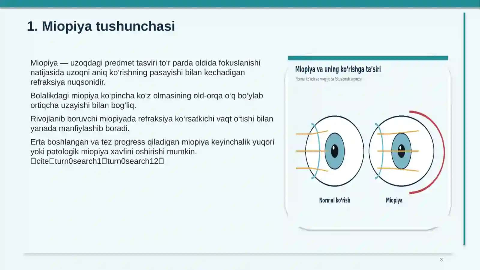 Mardonova Farog’atning Oftamologiya Fanidagi Prezentatsiya 3