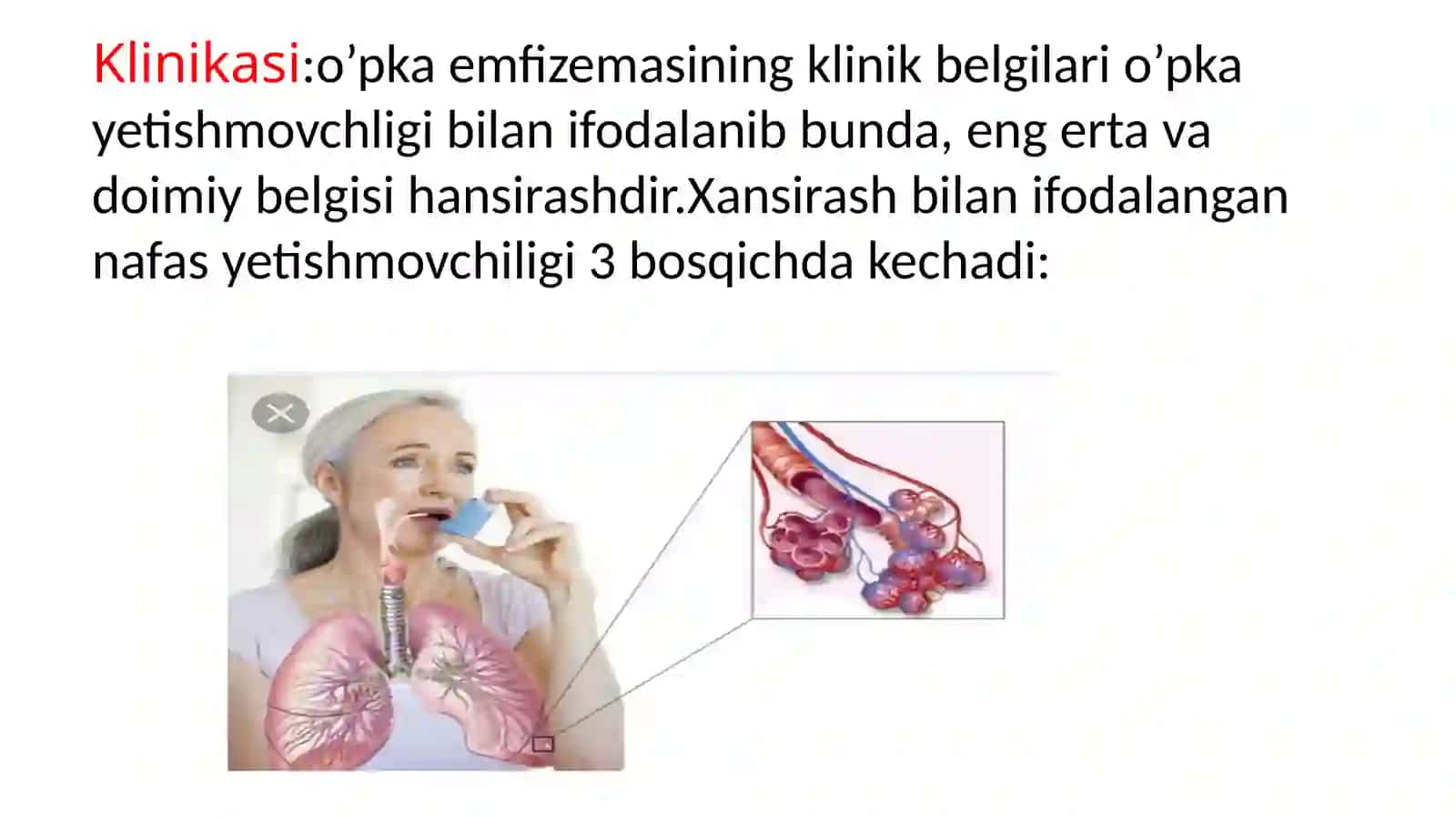 O’pka emfizemasi 3