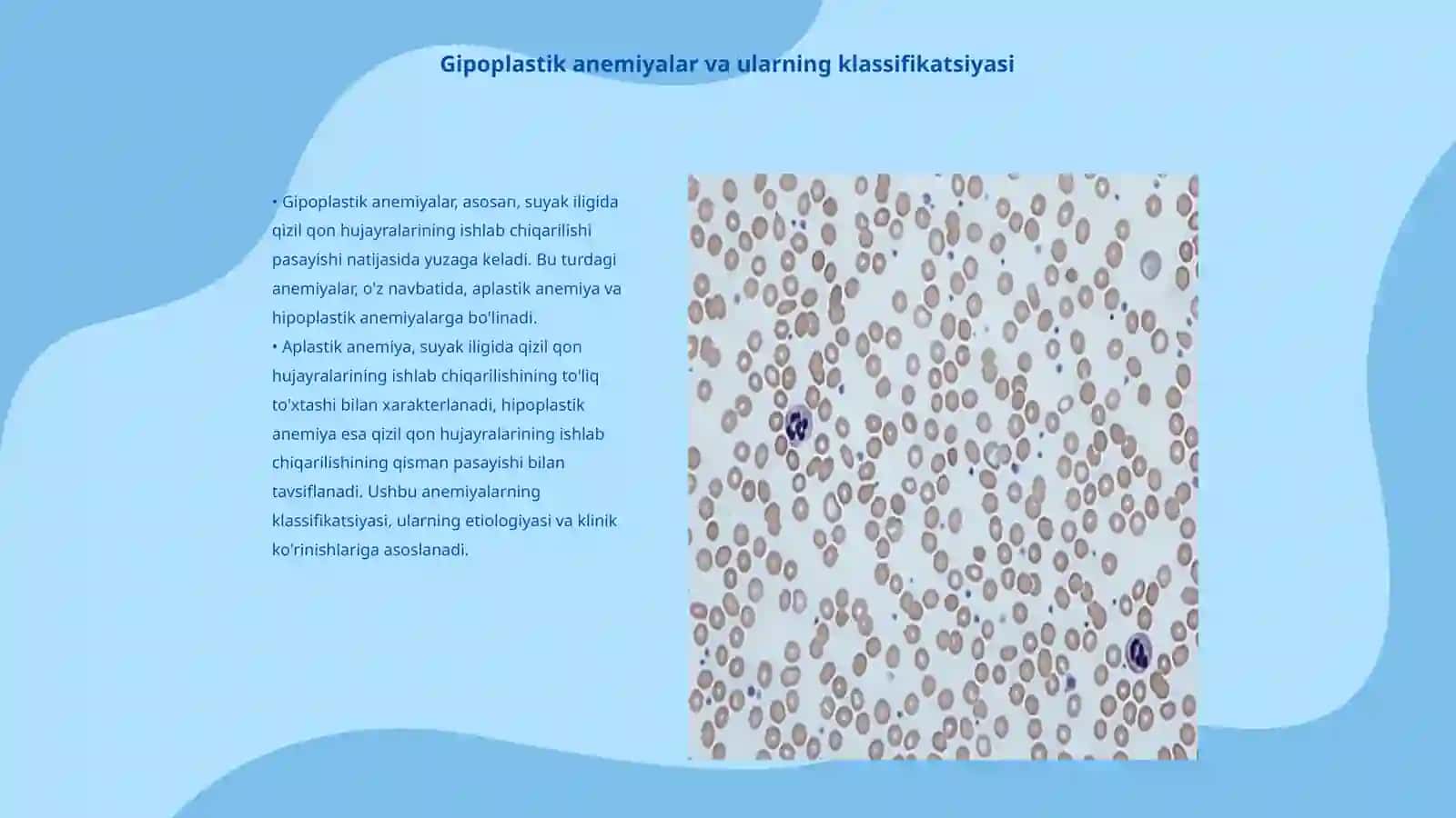 Gipoplastik anemiyalar. Etiologiya, patogenez, klinika, diagnostika va davolash prinsplari 3