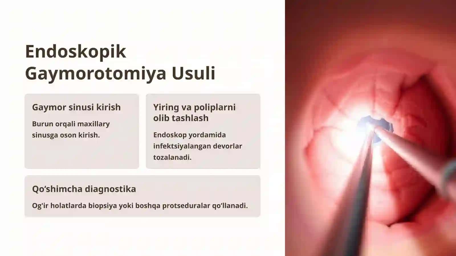 Endoskopik Fronto va Gaymorotomiya Usullari 3