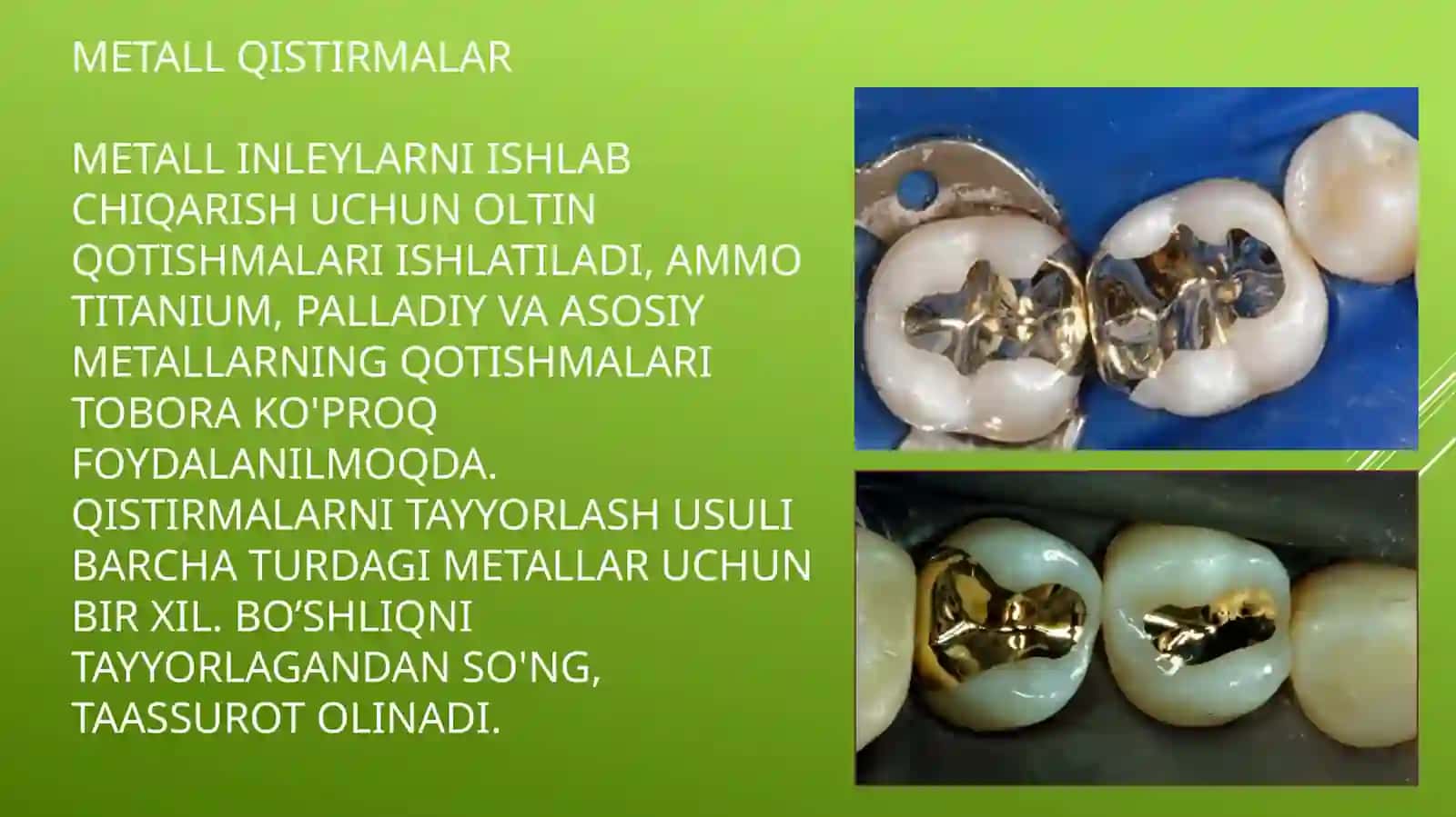 Metall qistirmalarni ishlab chiqarishning klinik va laboratoriy bosqichlari 3