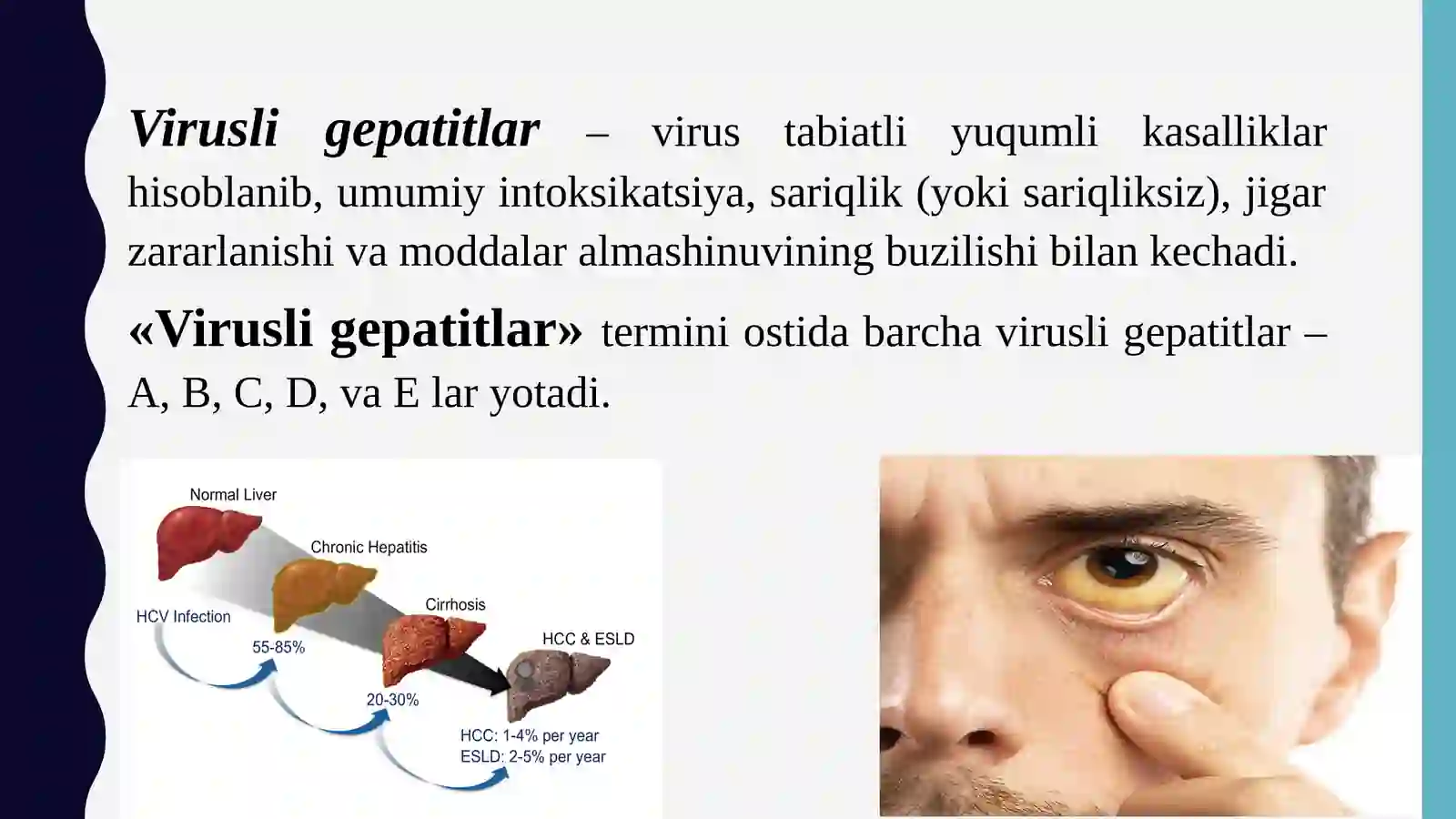 Gepatitlar 3