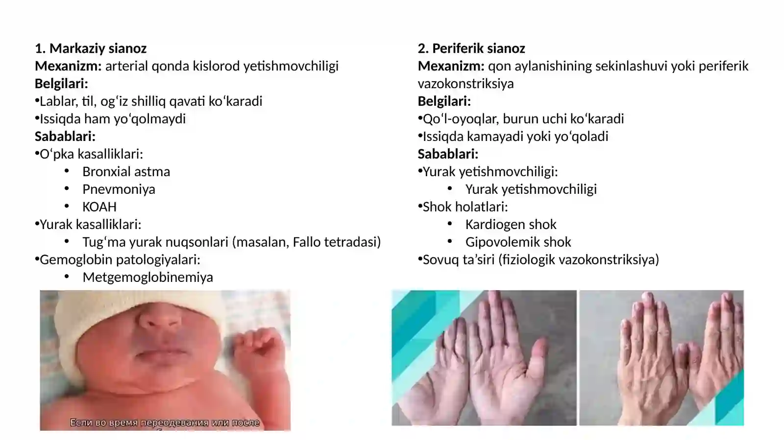 Sianoz bo'yicha differensial diagnostika 3