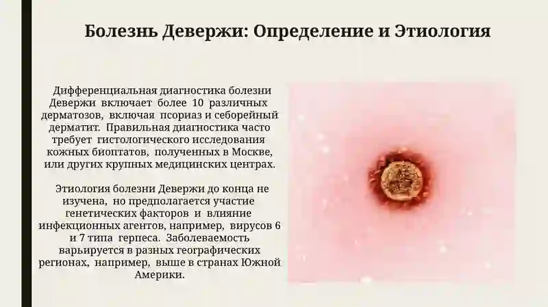 Болезнь Девержи 3