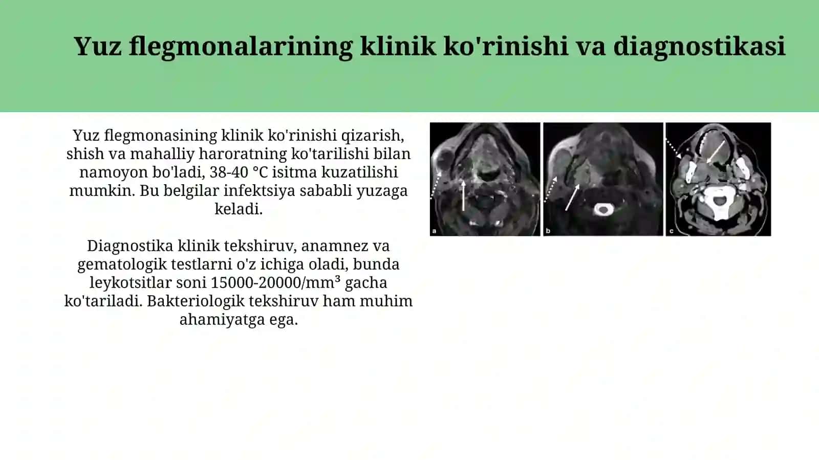 Yuzning yuza flegmonalarining ochish hamda drenejlashning klinik anatomik asoslari 3