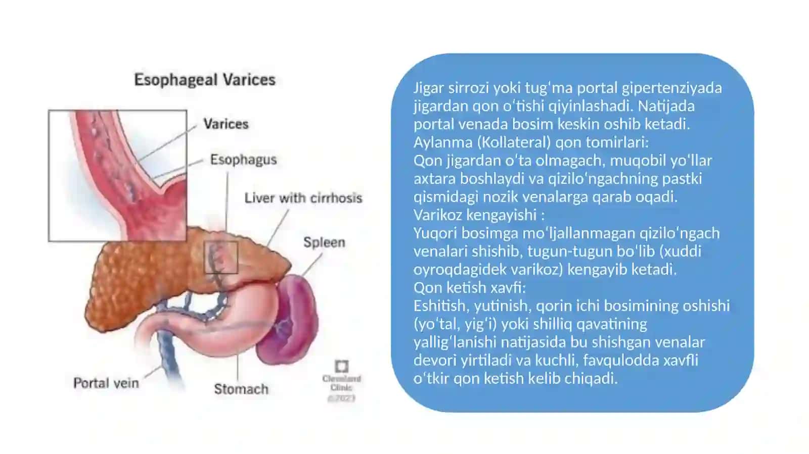 Bolalarda Qizilo`ngachdan qon ketish xolatlari 3