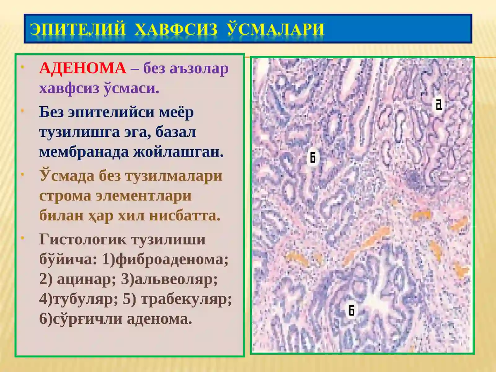 Ўсмалар. Мезенхимал ўсмалар 3