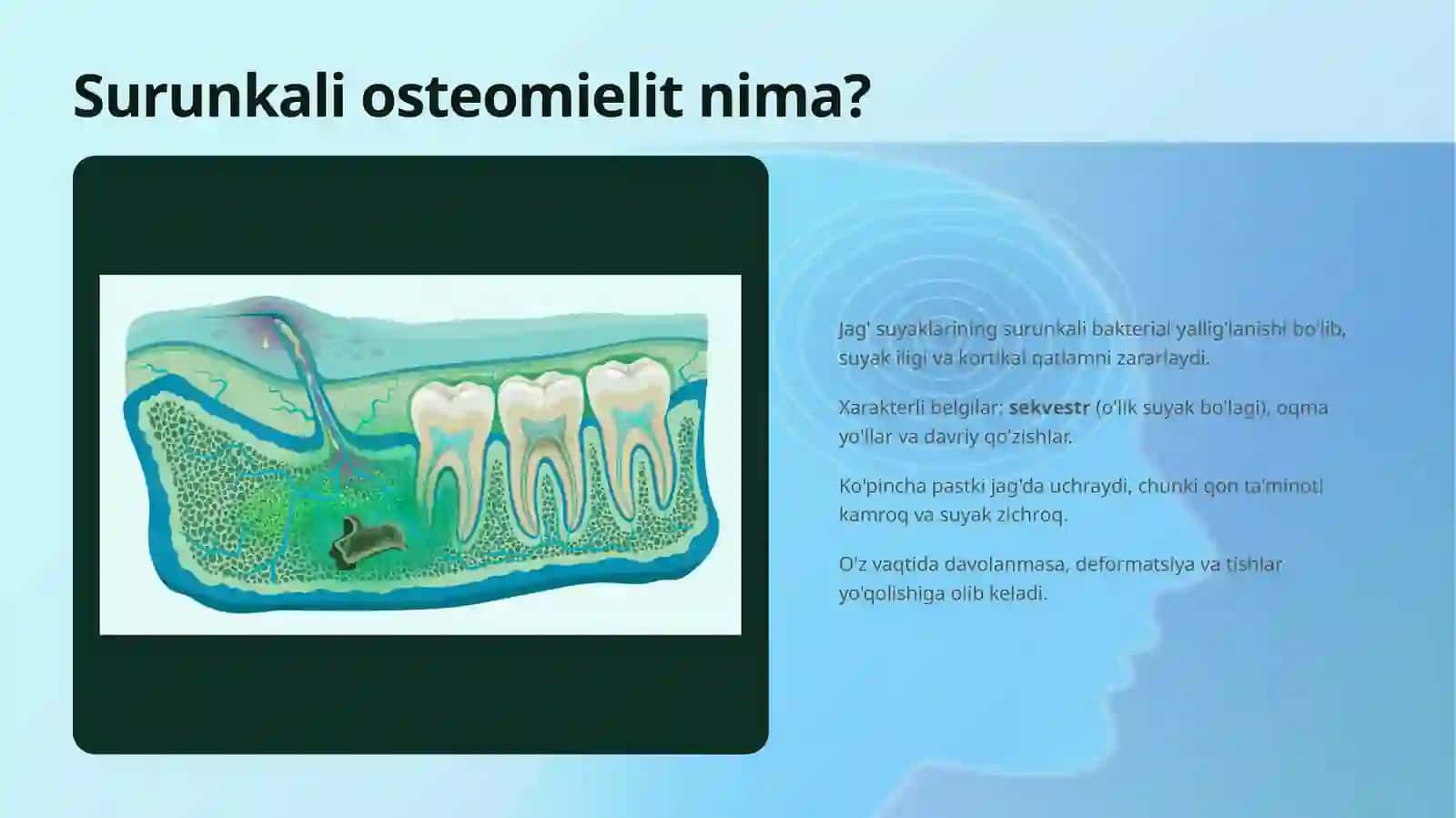 Surunkali Osteomielit Sekvestrekomiya Operatsiyasi 3