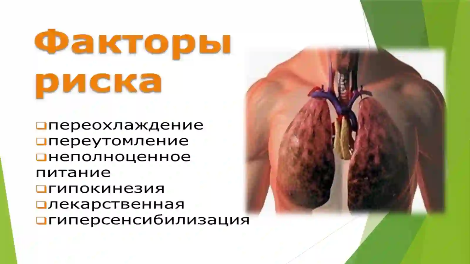 Плеврит 3