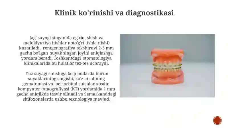 Tish va yuz jag‘ suyaklarini shikaslanishlari va sinishlari 3