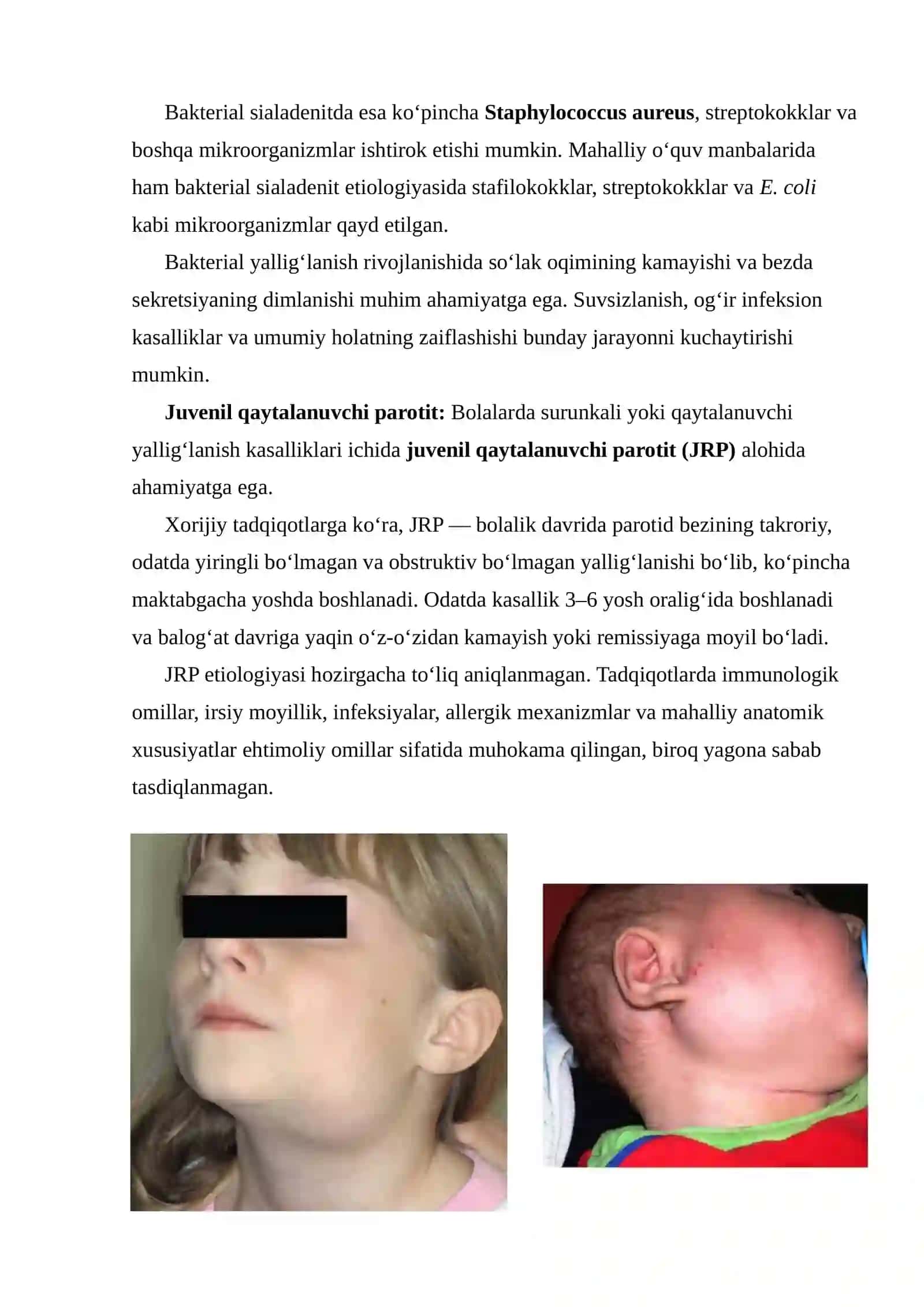 BOLALARDA SO‘LAK BEZLARINING O‘TKIR VA SURUNKALI YALLIG‘LANISH KASALLIKLARI: ETIOLOGIYASI VA KLINIK ASPEKTLARI 3