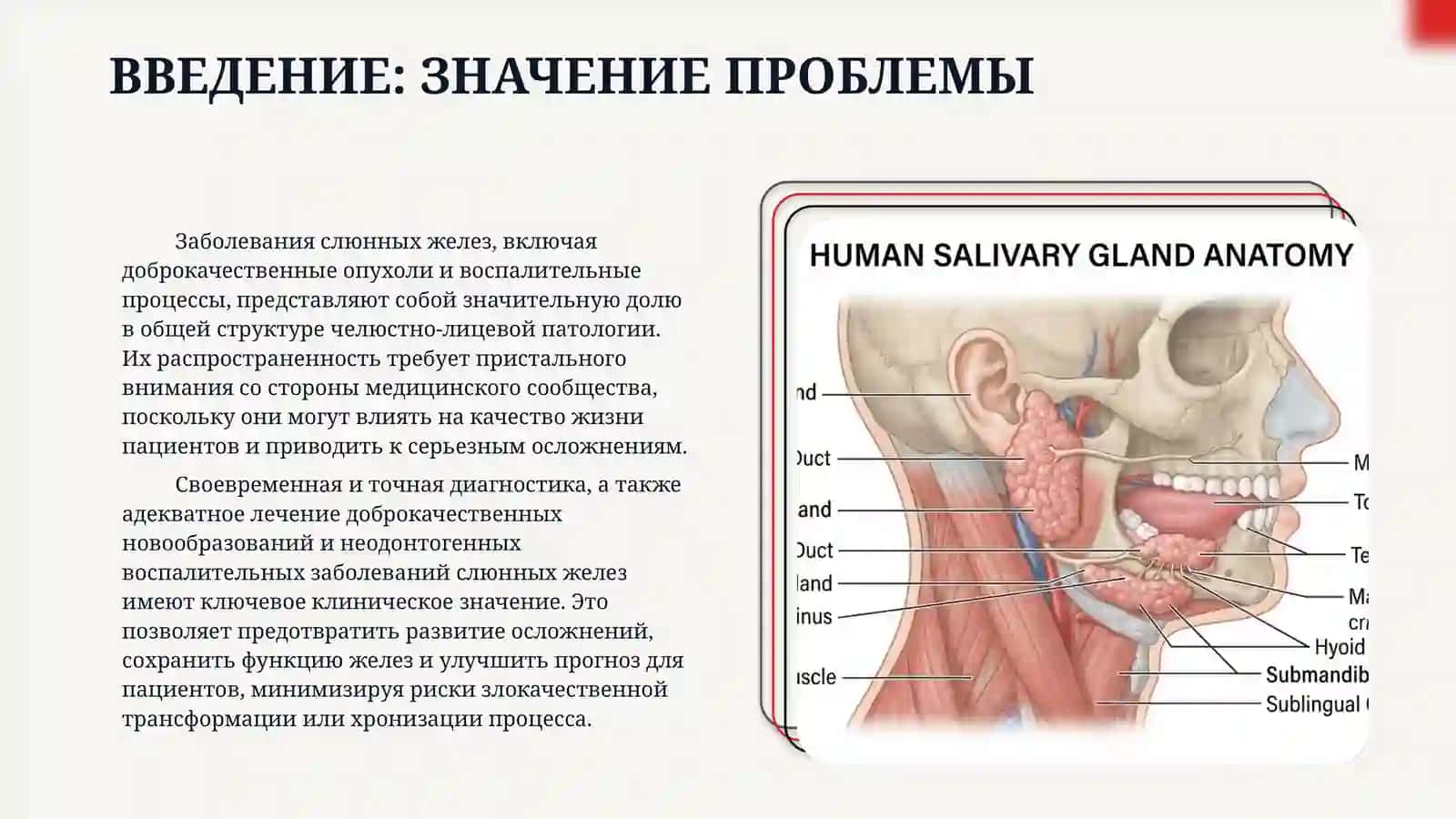 Доброкачественные опухоли слюнных желез. Неодонтогенные воспалительные заболевания: этиология, патогенез, диагностика и лечение 3