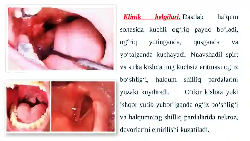 HALQUM KUYISHLARI 3
