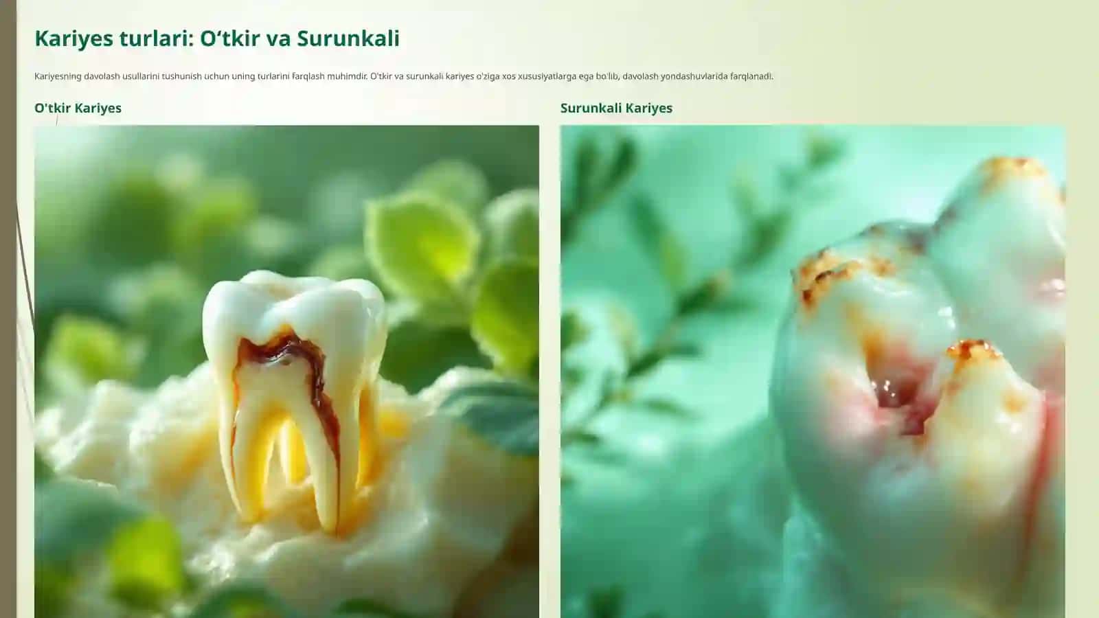 Oʻtkirva Surunkali Togʻ Bosqichdagi Kariyesni Davolash Usullari 3