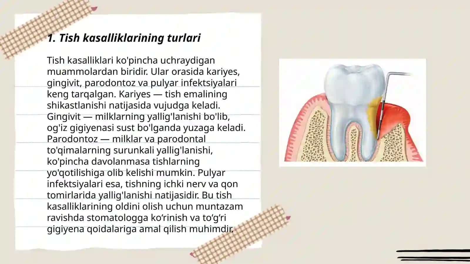Tish kasalliklari kareis pulpit periodontit. Tasnifi klinikasi, tashxisi va davolash. Ogʻiz boʻshligʻi shilliq qavati va paradont kasalliklari. Tasnifi, klinikasi, tashxisi, va davolash 3