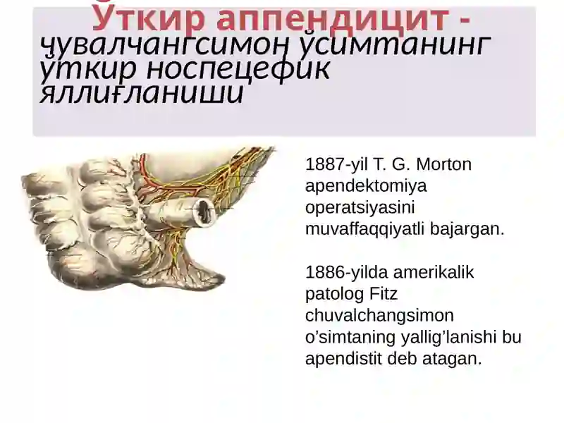 O`tkir appenditsit 3