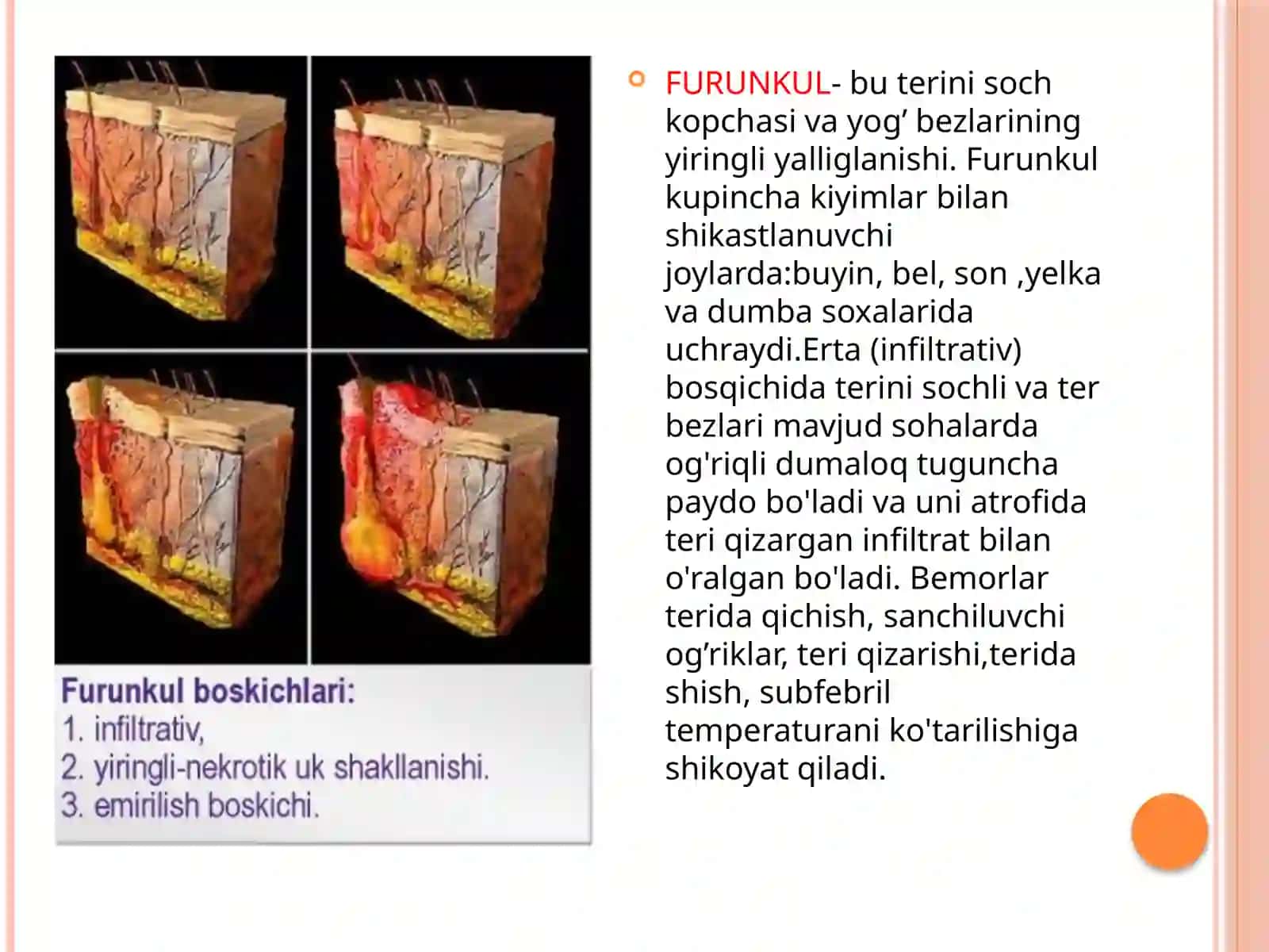Furunkul 3