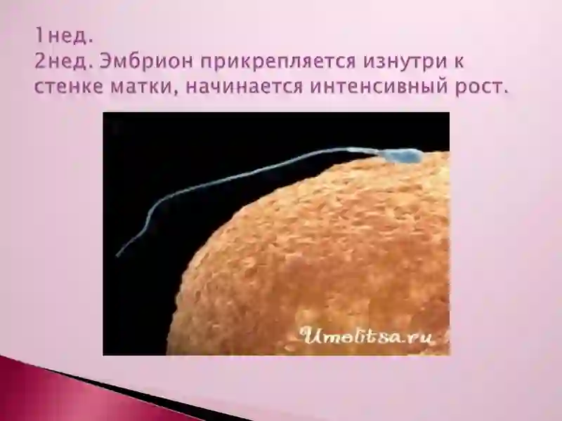 презентация на тему : Пренатальный период 3