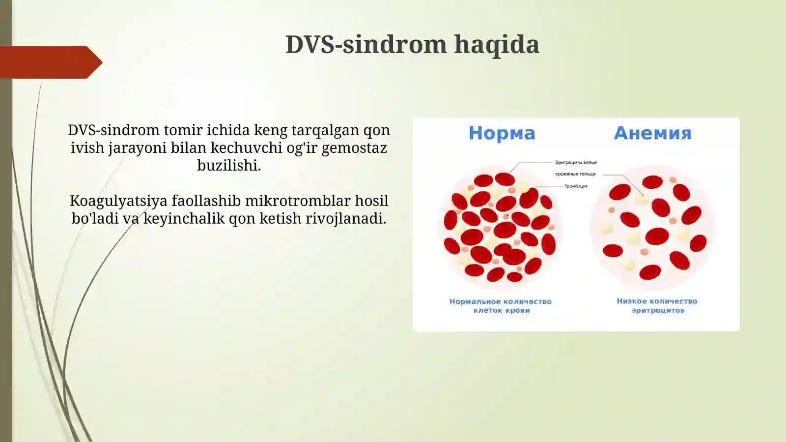 DVS - sindrom 3