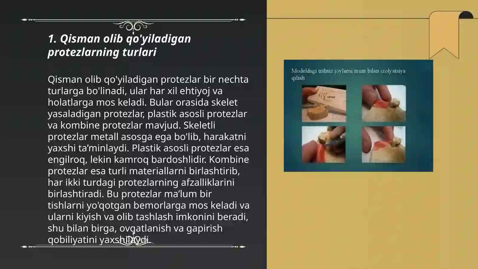 Qisman olib qóyiluvchi protezlarni implantatlar yordamida fiksatsiyasini oshirish 3