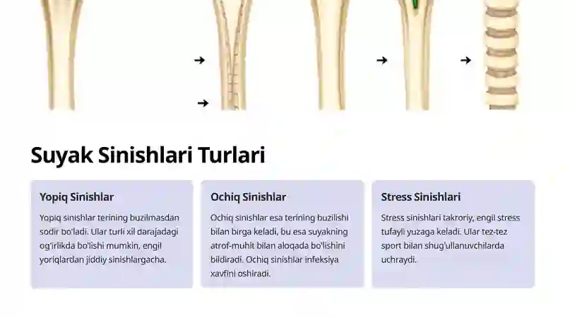 Suyak sinishlari 3