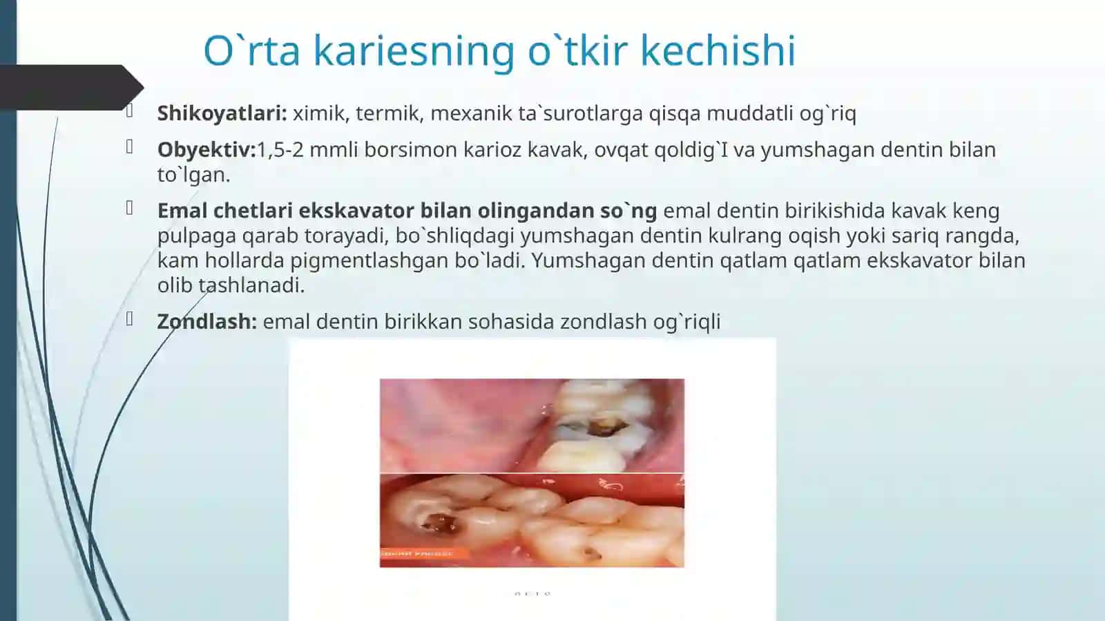 O`rtakaries O`tkir kechishi 3