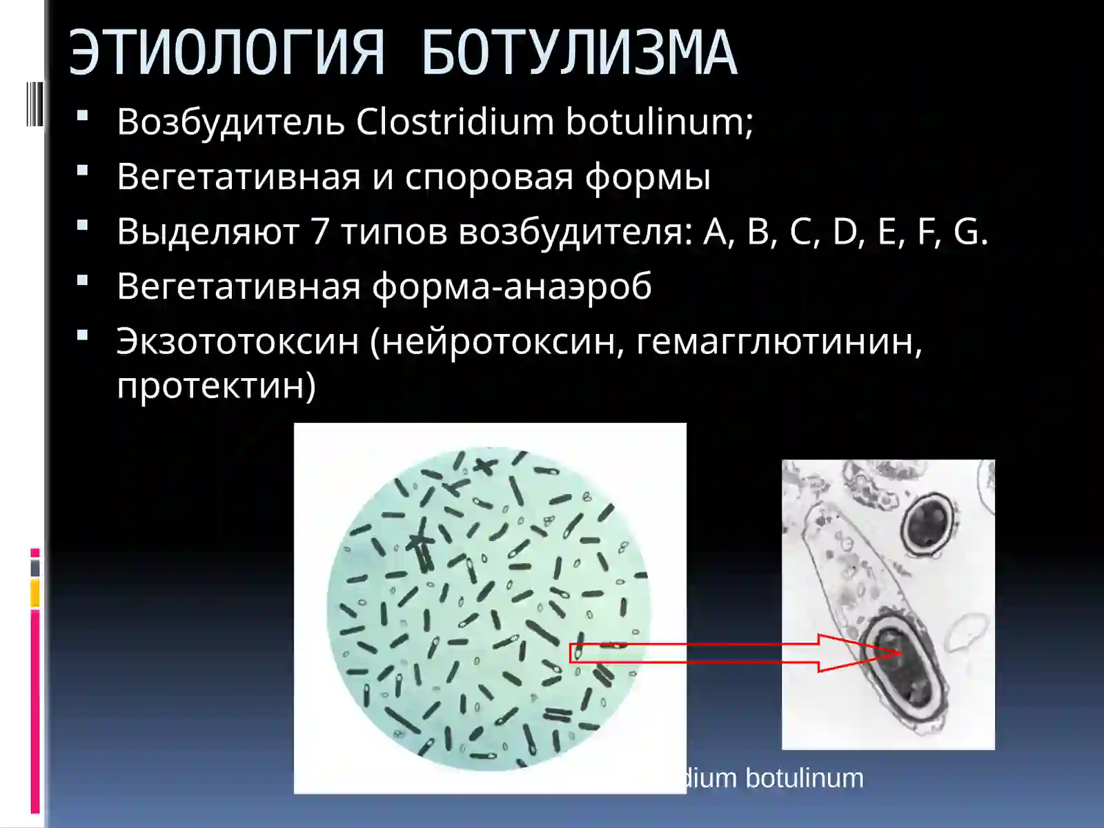 БОТУЛИЗМ 3