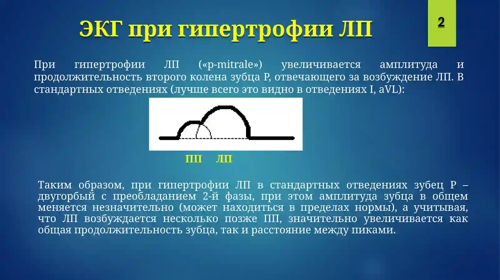 ЭКГГипертрофии, блокады 3