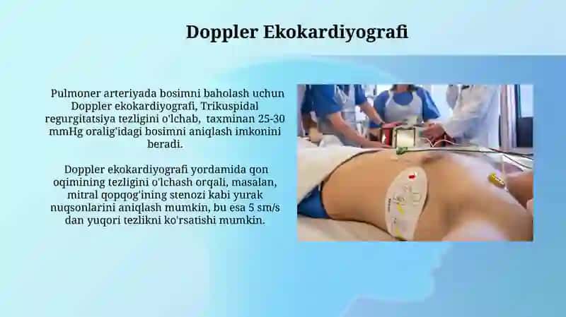 Ekokardiyografiya 3