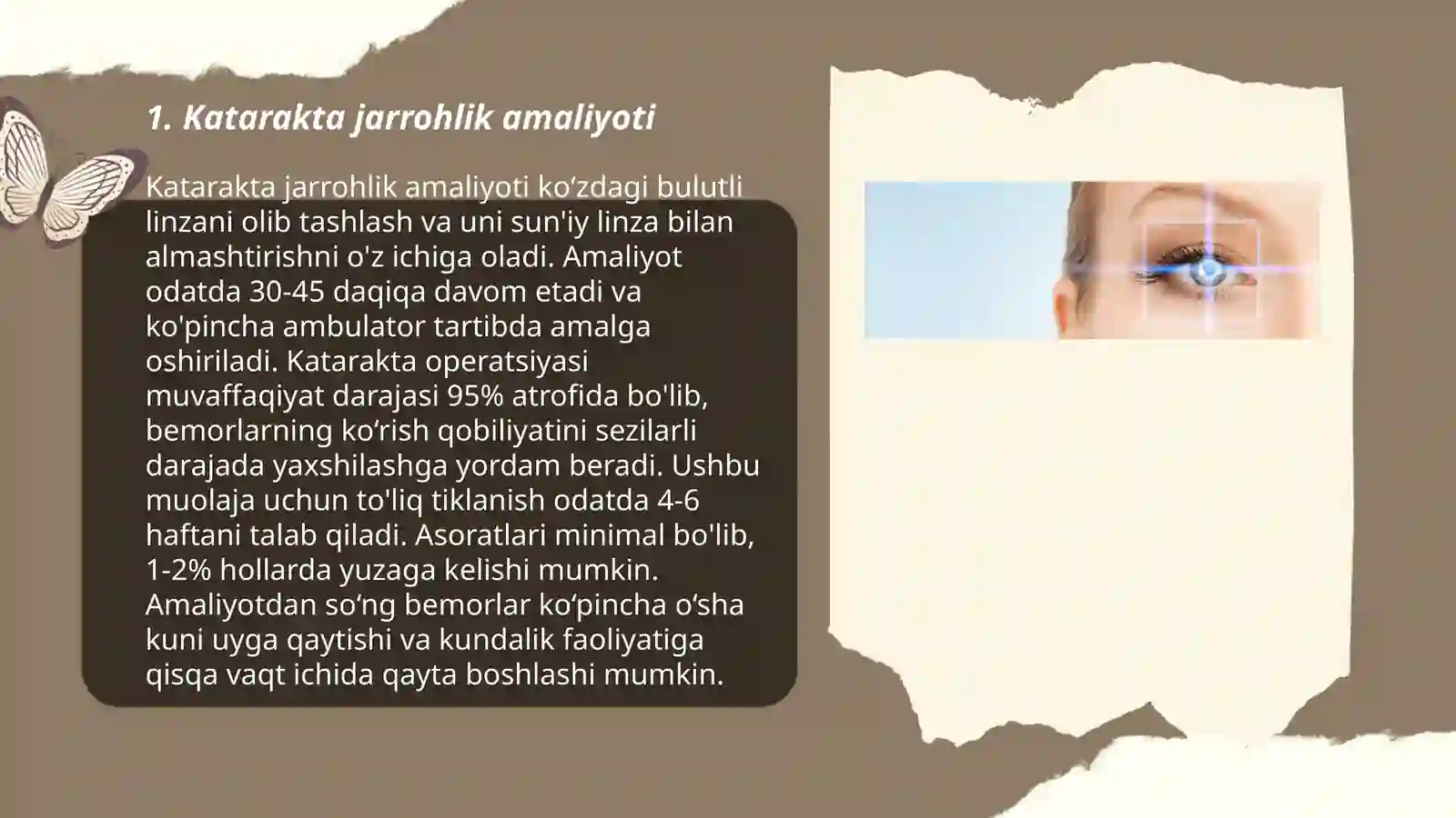 Eye surgery 3