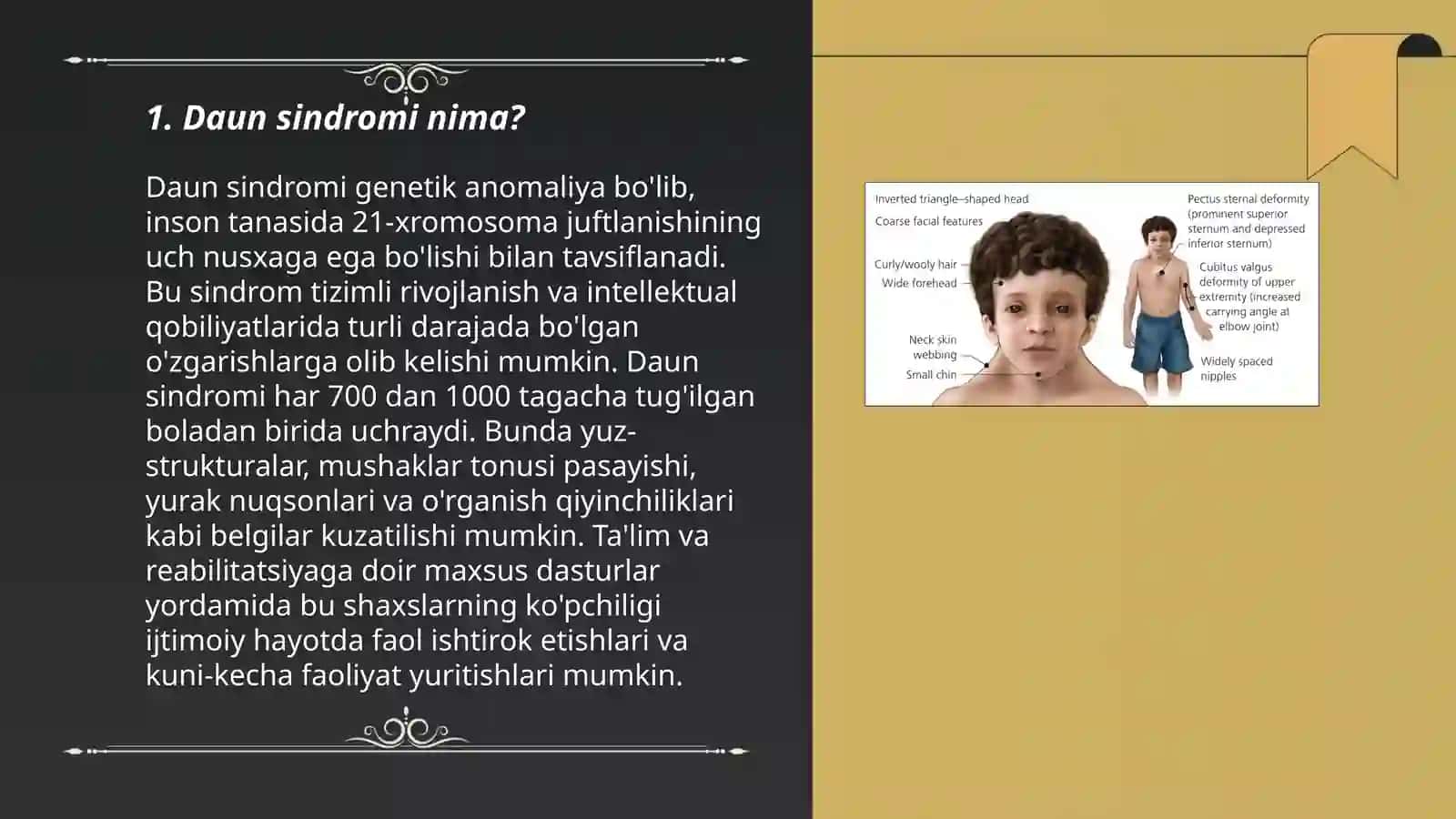Daun sindromi 3