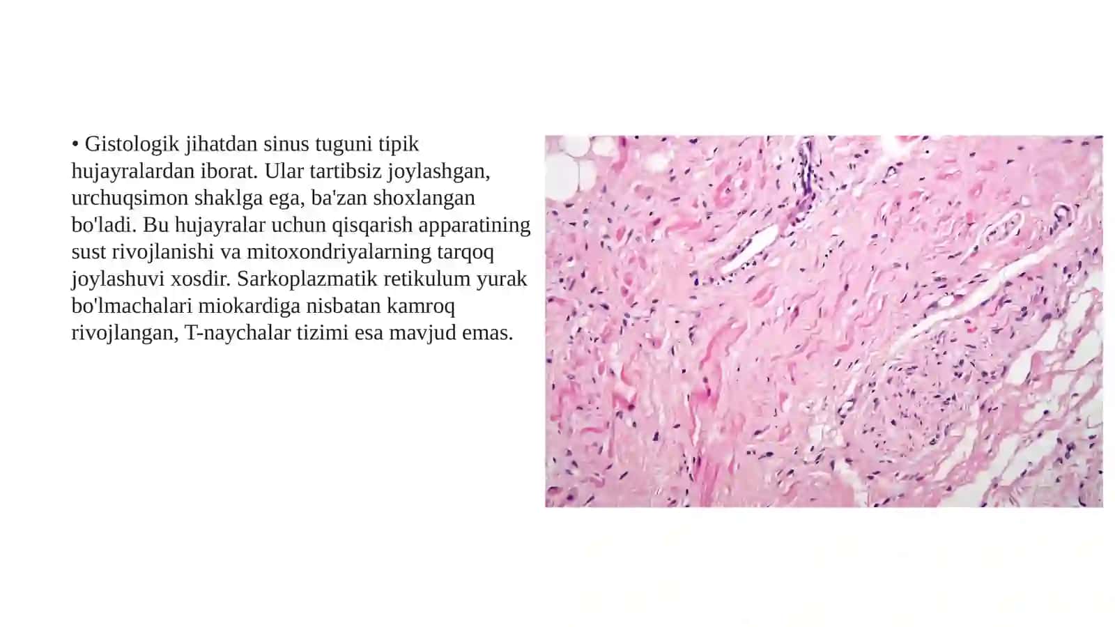 Sinus tuguni zaifligi sindromi (2-variant) 3