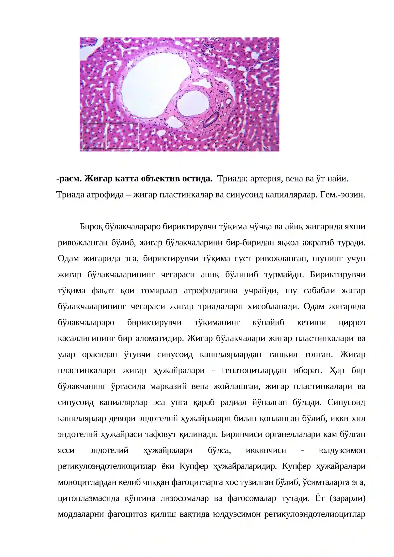 Жигар 3