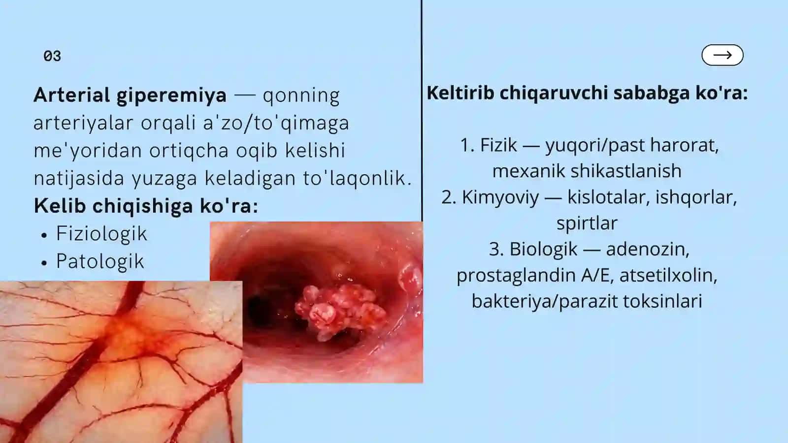 ARTERIAL VA VENOZ GIPERIMIYA 3