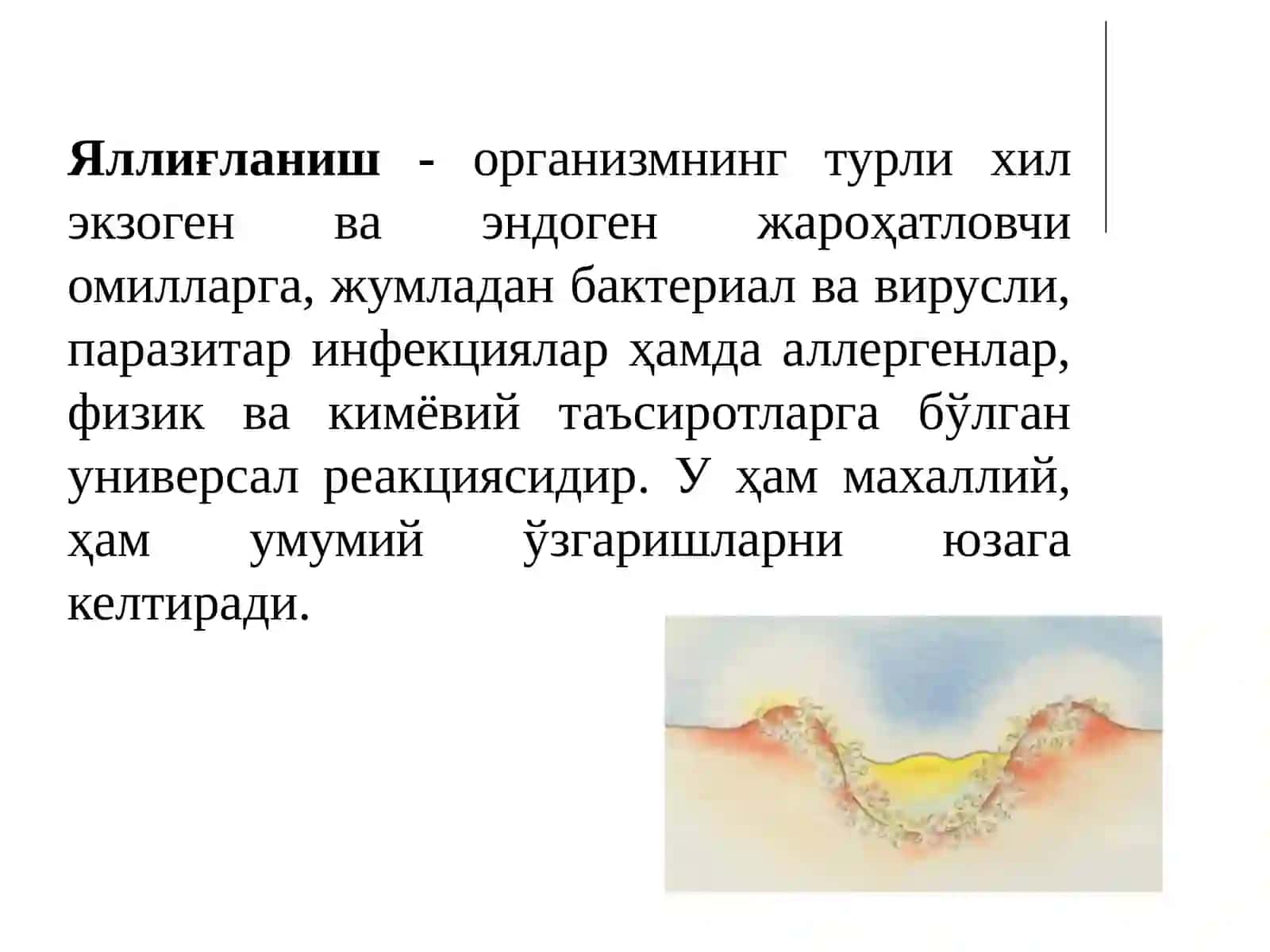 Стероид ва ностероид яллиғланишга қарши дори воситалари 3
