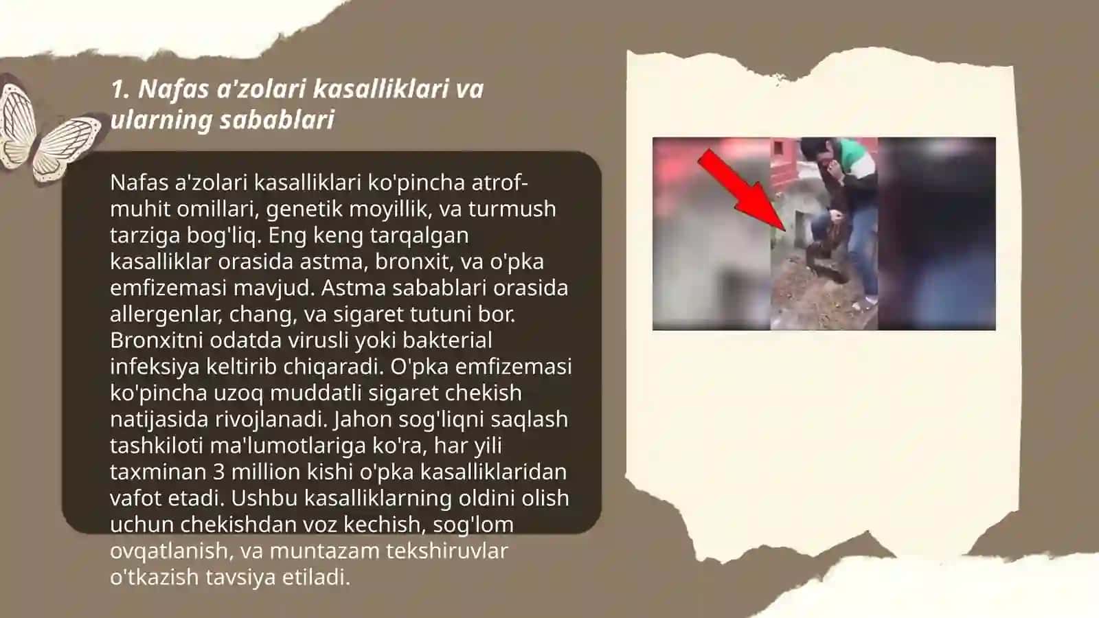 Nafas a'zolari kasalliklari bo'lgan bemorlar bilan muloqot 3